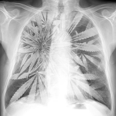 marijuana-lung-cancer Cannabis users ‘have lungs of 80-year-olds’: Doctors warn people are turning up at A&E with new form of emphysema after using drug for less than ten years